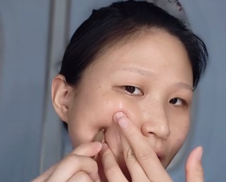 （顴髎穴位置）