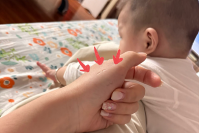1歲寶寶咬人