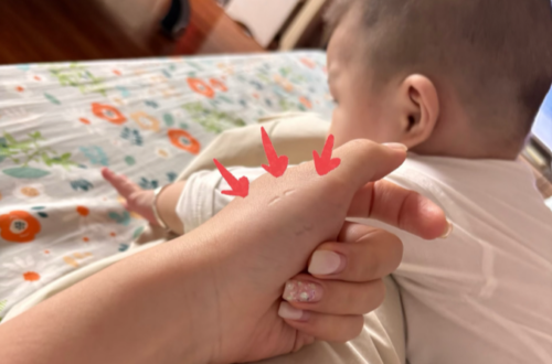 1歲寶寶咬人