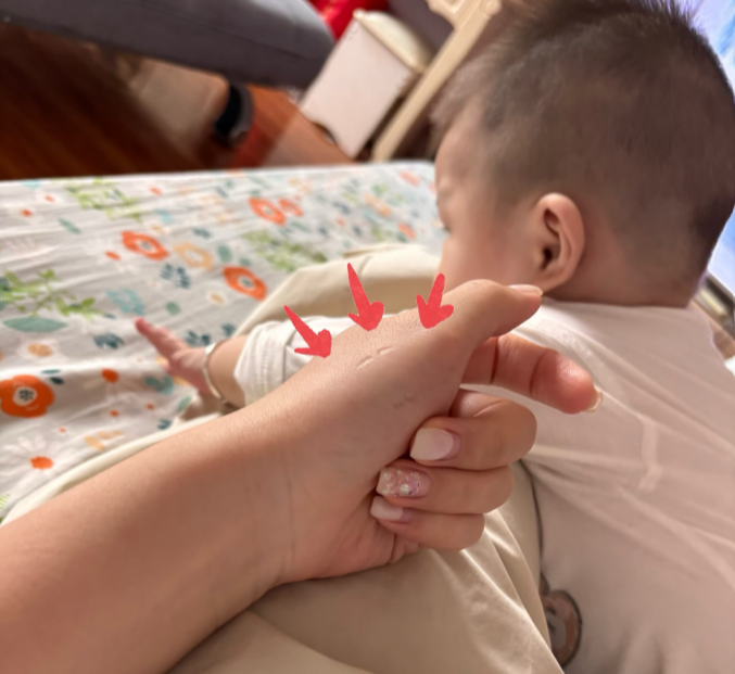 1歲寶寶咬人